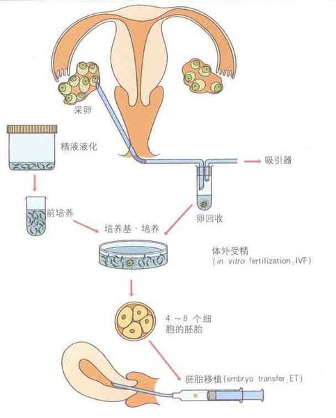 供卵试管婴儿会引起胎儿先天性心脏病-正常的胎儿心脏会有先天性心脏病吗？