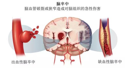 胚胎移植后有必要躺在床上休息吗？(原创)_供卵做试管婴儿_供卵做试管婴儿日常护理-