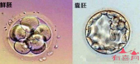 睡眠不好会影响供卵试管婴儿的成功率吗_充足的睡眠会使成功率提高