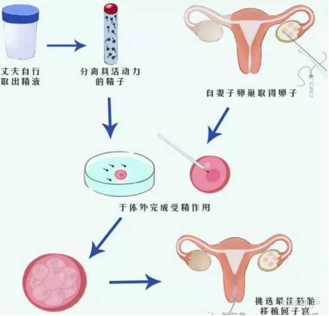供卵试管三代技术可以防止胚胎流产吗？