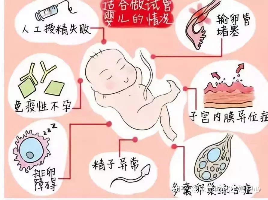 做供卵试管移植后需要卧床多少时间