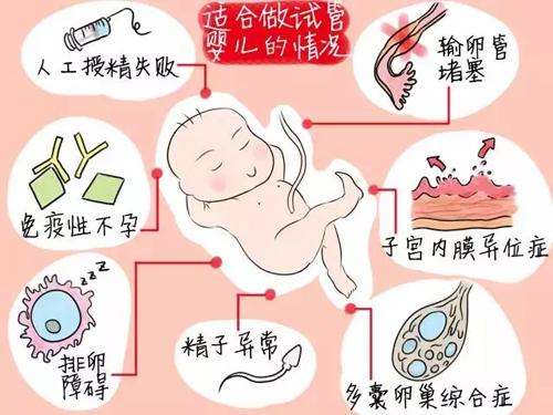 供卵试管取卵自然周期是什么意思