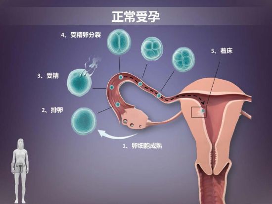 做借卵试管需要住院吗