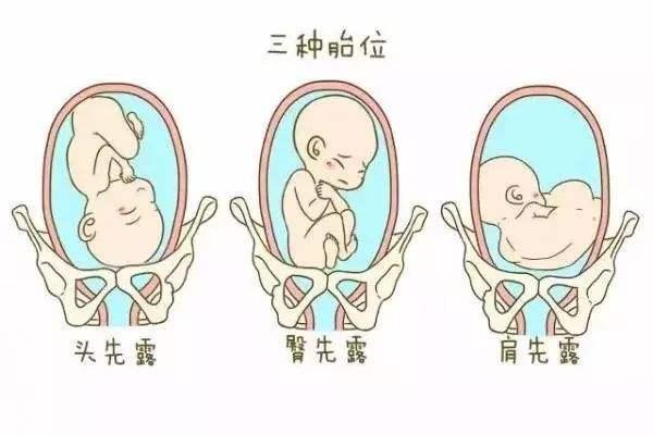 有些女性没有卵泡可以国内代生孩子价格解析